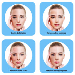 Image showing 4 benefits of Microdermabrasion devices. It is an ideal device purchase. 